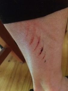 My bike bit me_25 Oct 14
